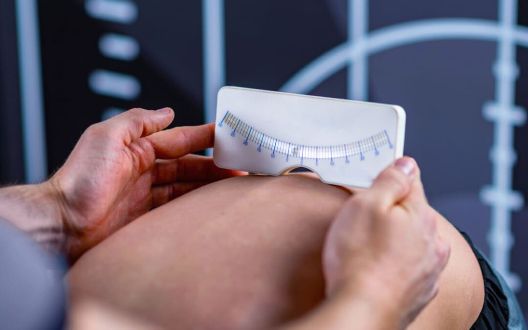 Cobb Angle: Understanding Spinal Curvature Measurement