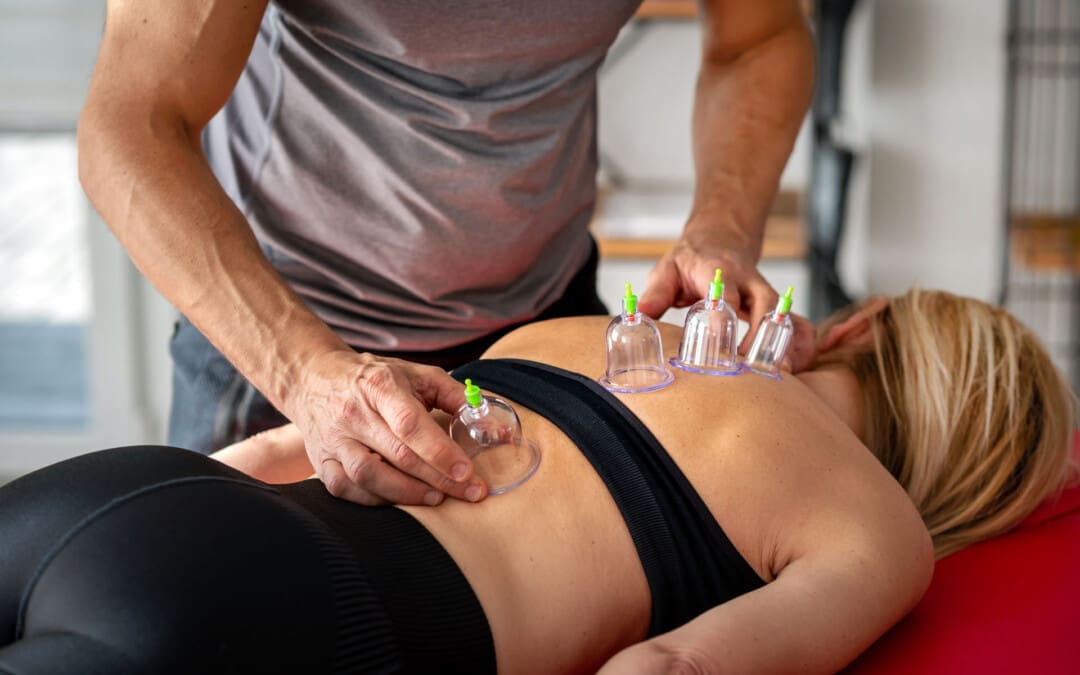 Cupping Benefits for Musculoskeletal Health