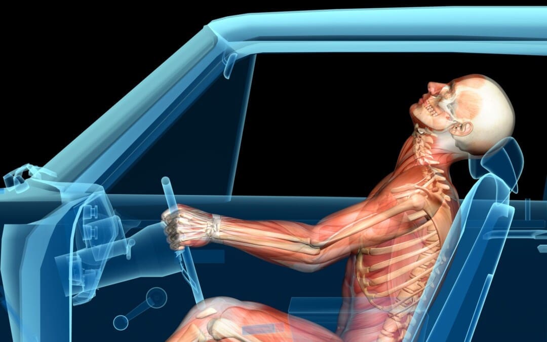Auto Accidents: Whiplash and Achilles Tendinosis Causes