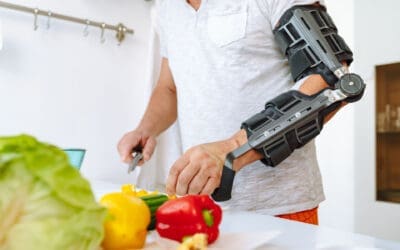 Nutrition for Accident Injuries During Recovery