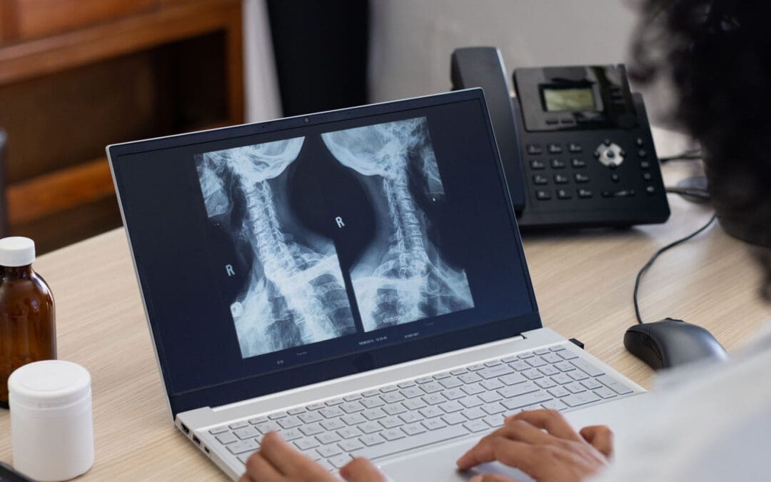 Faster Recovery After Spine Surgery Strategies