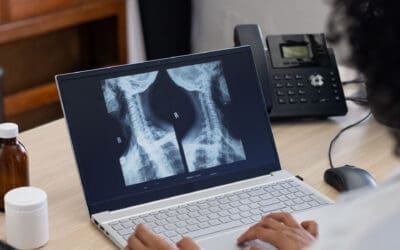 Faster Recovery After Spine Surgery Strategies