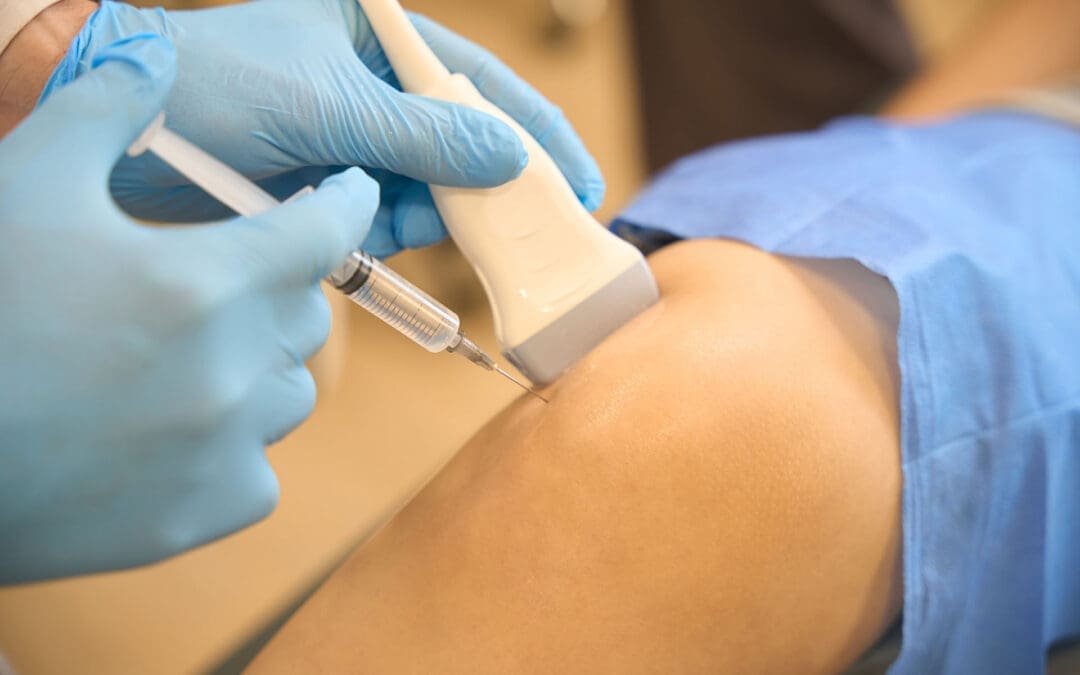 Sports Injuries and PRP Therapy for Faster Recovery