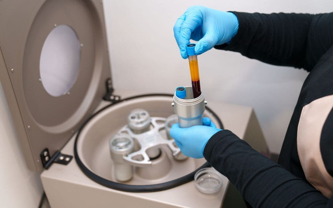 PRP Therapy in El Paso for Back Pain Relief